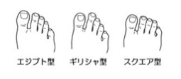 足の形イメージ